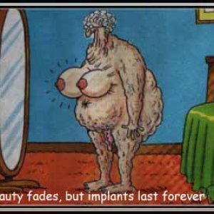 Implants Last Forever